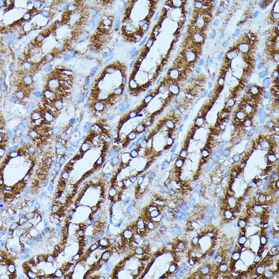 FGD1 Antibody - Immunohistochemistry of paraffin-embedded Mouse kidney using FGD1 Polyclonal Antibody at dilution of 1:100 (40x lens).