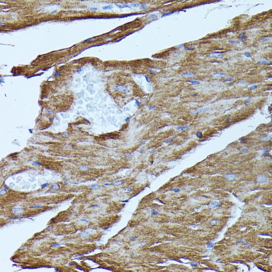 FGD1 Antibody - Immunohistochemistry of paraffin-embedded Mouse heart using FGD1 Polyclonal Antibody at dilution of 1:100 (40x lens).