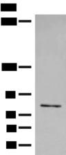 FGD3 Antibody - Western blot analysis of Jurkat cell lysate  using FGD3 Polyclonal Antibody at dilution of 1:500