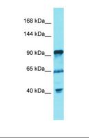 FGD5 Antibody - Western blot of Human U937. FGD5 antibody dilution 1.0 ug/ml.  This image was taken for the unconjugated form of this product. Other forms have not been tested.