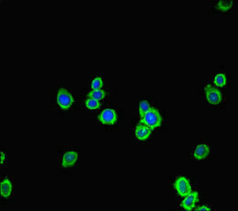 FGD5 Antibody - Immunofluorescent analysis of HepG-2 cells diluted at 1:100 and Alexa Fluor 488-congugated AffiniPure Goat Anti-Rabbit IgG(H+L)