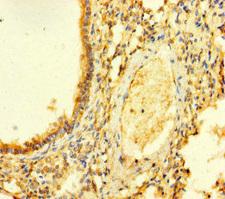 FGD5 Antibody - Immunohistochemistry of paraffin-embedded human lung tissue at dilution of 1:100