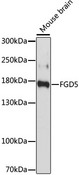 FGD5 Antibody - Western blot analysis of extracts of Mouse brain, using FGD5 antibody at 1:1000 dilution. The secondary antibody used was an HRP Goat Anti-Rabbit IgG (H+L) at 1:10000 dilution. Lysates were loaded 25ug per lane and 3% nonfat dry milk in TBST was used for blocking. An ECL Kit was used for detection and the exposure time was 60s.