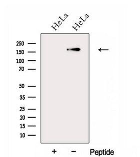 FGD5 Antibody - Western blot analysis of extracts of HeLa cells using FGD5 antibody. The lane on the left was treated with blocking peptide.