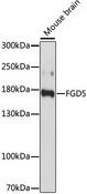 FGD5 Antibody - Western blot analysis of extracts of Mouse brain using FGD5 Polyclonal Antibody at dilution of 1:1000.