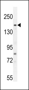 FGD6 Antibody - FGD6 Antibody western blot of A549 cell line lysates (35 ug/lane). The FGD6 antibody detected the FGD6 protein (arrow).