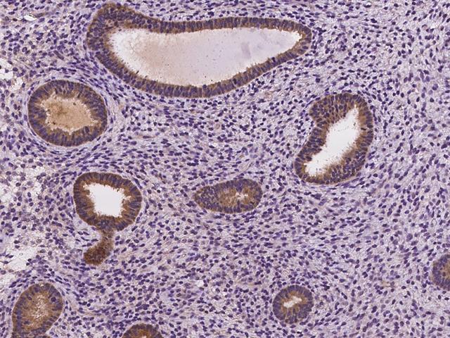 FGD6 Antibody - Immunochemical staining of human FGD6 in human corpus uteri with rabbit polyclonal antibody at 1:500 dilution, formalin-fixed paraffin embedded sections.