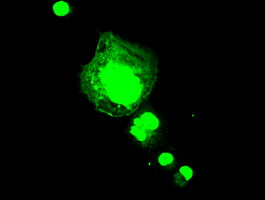 FGF1 / Acidic FGF Antibody - Anti-AFGF mouse monoclonal antibody immunofluorescent staining of COS7 cells transiently transfected by pCMV6-ENTRY AFGF.
