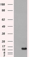 FGF1 / Acidic FGF Antibody - HEK293T cells were transfected with the pCMV6-ENTRY control (Left lane) or pCMV6-ENTRY AFGF (Right lane) cDNA for 48 hrs and lysed. Equivalent amounts of cell lysates (5 ug per lane) were separated by SDS-PAGE and immunoblotted with anti-AFGF.