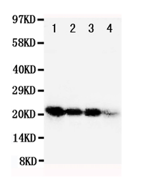 FGF1 / Acidic FGF Antibody - Anti-human FGF1 antibody, Western blotting Lane 1: Recombinant Human FGF1 Protein 10ng Lane 2: Recombinant Human FGF1 Protein 5ng Lane 3: Recombinant Human FGF1 Protein 2