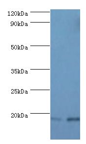 FGF1 / Acidic FGF Antibody - Western blot. All lanes: Fibroblast growth factor 1 antibody at 6 ug/ml. Lane 1: mouse kidney tissue. Lane 2: mouse heart tissue. Secondary antibody: Goat polyclonal to rabbit at 1:10000 dilution. Predicted band size: 17 kDa. Observed band size: 17 kDa Immunohistochemistry.