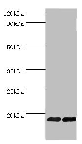 FGF1 / Acidic FGF Antibody - Western blot All lanes: Fibroblast growth factor 1 antibody at 6µg/ml Lane 1: Mouse kidney tissue Lane 2: Mouse heart tissue Secondary Goat polyclonal to rabbit IgG at 1/10000 dilution Predicted band size: 18, 7 kDa Observed band size: 18 kDa