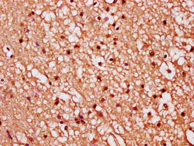 FGF1 / Acidic FGF Antibody - IHC image of FGF1 Antibody diluted at 1:289 and staining in paraffin-embedded human brain tissue performed on a Leica BondTM system. After dewaxing and hydration, antigen retrieval was mediated by high pressure in a citrate buffer (pH 6.0). Section was blocked with 10% normal goat serum 30min at RT. Then primary antibody (1% BSA) was incubated at 4°C overnight. The primary is detected by a biotinylated secondary antibody and visualized using an HRP conjugated SP system.