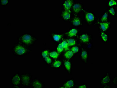 FGF1 / Acidic FGF Antibody - Immunofluorescence staining of Hela cells with FGF1 Antibody at 1:96, counter-stained with DAPI. The cells were fixed in 4% formaldehyde, permeabilized using 0.2% Triton X-100 and blocked in 10% normal Goat Serum. The cells were then incubated with the antibody overnight at 4°C. The secondary antibody was Alexa Fluor 488-congugated AffiniPure Goat Anti-Rabbit IgG(H+L).