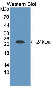 FGF1 / Acidic FGF Antibody - Western blot of FGF1 / Acidic FGF antibody.