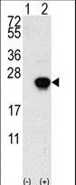 FGF1 / Acidic FGF Antibody - Western blot of FGF1 (arrow) using rabbit polyclonal FGF1 Antibody. 293 cell lysates (2 ug/lane) either nontransfected (Lane 1) or transiently transfected with the FGF1 gene (Lane 2) (Origene Technologies).