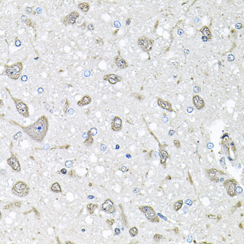 FGF1 / Acidic FGF Antibody - Immunohistochemistry of paraffin-embedded rat brain using FGF1 antibodyat dilution of 1:100 (40x lens).