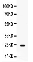 FGF1 / Acidic FGF Antibody - Western blot analysis of FGF1 expression in rat cardiac muscle extract (lane 1). FGF1 at 24KD was detected using rabbit anti-FGF1 Antigen Affinity purified polyclonal antibody at 0.5 ug/ml. The blot was developed using chemiluminescence (ECL) method.