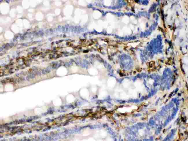 FGF1 / Acidic FGF Antibody - FGF1 was detected in paraffin-embedded sections of rat intestine tissues using rabbit anti-FGF1 Antigen Affinity purified polyclonal antibody at 1 µg/mL. The immunohistochemical section was developed using SABC method