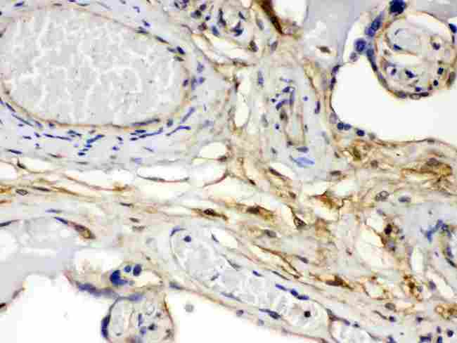 FGF1 / Acidic FGF Antibody - FGF1 was detected in paraffin-embedded sections of human placenta tissues using rabbit anti-FGF1 Antigen Affinity purified polyclonal antibody at 1 µg/mL. The immunohistochemical section was developed using SABC method