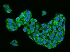 FGF1 / Acidic FGF Antibody - Immunofluorescence staining of FGF1 in HepG2 cells. Cells were fixed with 4% PFA, permeabilzed with 0.1% Triton X-100 in PBS, blocked with 10% serum, and incubated with rabbit anti-Human FGF1 polyclonal antibody (dilution ratio 1:200) at 4°C overnight. Then cells were stained with the Alexa Fluor 488-conjugated Goat Anti-rabbit IgG secondary antibody (green) and counterstained with DAPI (blue). Positive staining was localized to Cytoplasm.