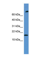FGF1 / Acidic FGF Antibody - FGF1 antibody Western blot of Mouse Heart lysate. This image was taken for the unconjugated form of this product. Other forms have not been tested.