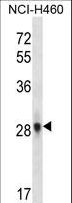 FGF10 Antibody - FGF10 Antibody western blot of NCI-H460 cell line lysates (35 ug/lane). The FGF10 antibody detected the FGF10 protein (arrow).
