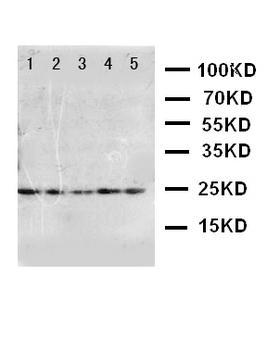 FGF10 Antibody - WB of FGF10 antibody. Lane 1: U87 Cell Lysate. Lane 2: HELA Cell Lysate. Lane 3: A519 Cell Lysate. Lane 4: 293T Cell Lysate. Lane 5: HELA Cell Lysate.