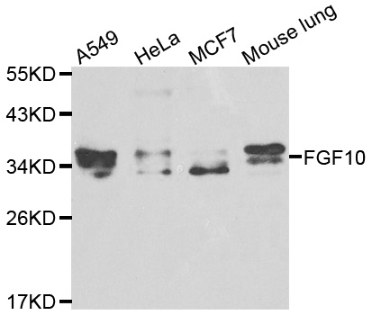 FGF10 Antibody - Western blot analysis of extracts of various cell lines, using FGF10 antibody at 1:1000 dilution. The secondary antibody used was an HRP Goat Anti-Rabbit IgG (H+L) at 1:10000 dilution. Lysates were loaded 25ug per lane and 3% nonfat dry milk in TBST was used for blocking.
