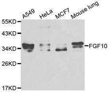 FGF10 Antibody - Western blot analysis of extracts of various cell lines, using FGF10 antibody at 1:1000 dilution. The secondary antibody used was an HRP Goat Anti-Rabbit IgG (H+L) at 1:10000 dilution. Lysates were loaded 25ug per lane and 3% nonfat dry milk in TBST was used for blocking.