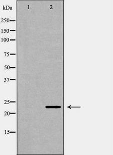 FGF10 Antibody - Western blot analysis of lung1 lysate using FGF10 antibody. The lane on the left is treated with the antigen-specific peptide.