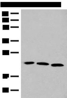 FGF10 Antibody - Western blot analysis of A549 HUVEC and 231 cell lysates  using FGF10 Polyclonal Antibody at dilution of 1:200