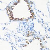 FGF10 Antibody - Immunohistochemistry of paraffin-embedded Mouse lung using FGF10 Polyclonal Antibody at dilution of 1:100 (40x lens).