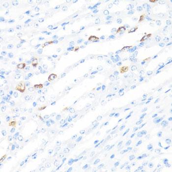 FGF10 Antibody - Immunohistochemistry of paraffin-embedded Mouse kidney using FGF10 Polyclonal Antibody at dilution of 1:100 (40x lens).