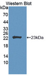 FGF11 / FGF-11 Antibody - Western blot of FGF11 / FGF-11 antibody.