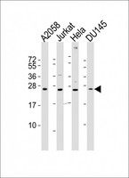FGF11 / FGF-11 Antibody - All lanes : Anti-FGF11 Antibody at 1:2000 dilution Lane 1: A2058 whole cell lysates Lane 2: Jurkat whole cell lysates Lane 3: HeLa whole cell lysates Lane 4: DU145 whole cell lysates Lysates/proteins at 20 ug per lane. Secondary Goat Anti-Rabbit IgG, (H+L), Peroxidase conjugated at 1/10000 dilution Predicted band size : 25 kDa Blocking/Dilution buffer: 5% NFDM/TBST.