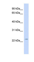 FGF11 / FGF-11 Antibody - FGF11 antibody Western blot of Fetal muscle lysate. This image was taken for the unconjugated form of this product. Other forms have not been tested.