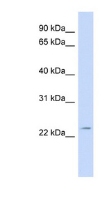 FGF11 / FGF-11 Antibody - FGF11 antibody Western blot of Fetal muscle lysate. This image was taken for the unconjugated form of this product. Other forms have not been tested.