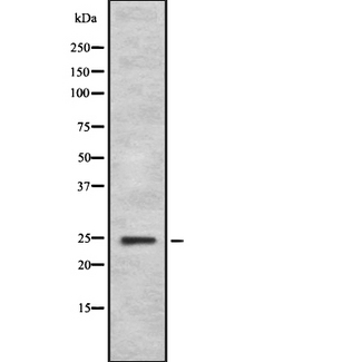 FGF11 / FGF-11 Antibody - Western blot analysis FGF11 using HeLa whole cells lysates