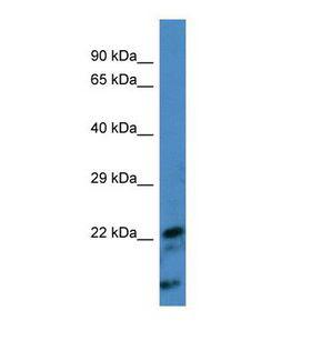 FGF11 / FGF-11 Antibody - Western blot of Human Jurkat. FGF11 antibody dilution 1.0 ug/ml.  This image was taken for the unconjugated form of this product. Other forms have not been tested.