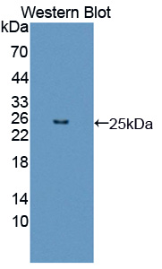 FGF12 Antibody - Western blot of FGF12 antibody.