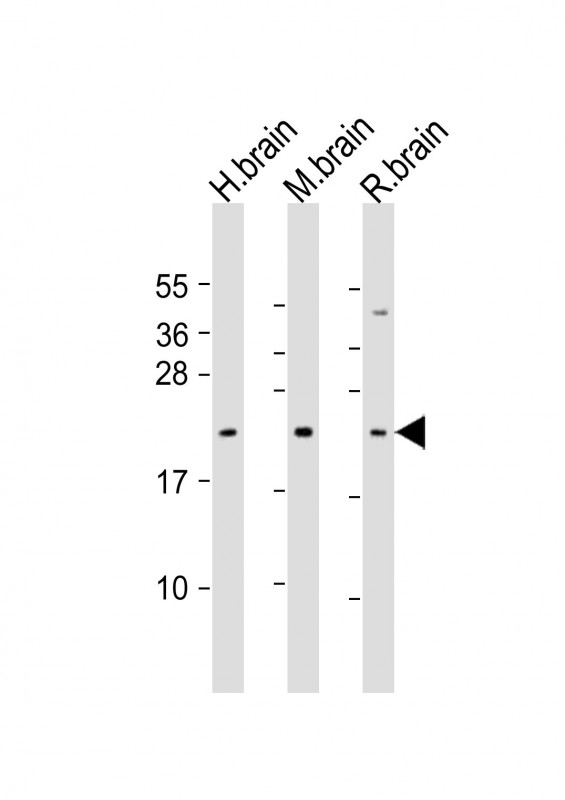 FGF12 Antibody - All lanes: Anti-FGF12 Antibody (Center) at 1:1000 dilution. Lane 1: human brain lysate. Lane 2: mouse brain lysate. Lane 3: rat brain lysate Lysates/proteins at 20 ug per lane. Secondary Goat Anti-Rabbit IgG, (H+L), Peroxidase conjugated at 1:10000 dilution. Predicted band size: 27 kDa. Blocking/Dilution buffer: 5% NFDM/TBST.