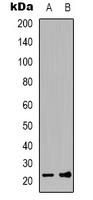FGF12 Antibody - Western blot analysis of FGF12 expression in HeLa (A); SHSY5Y (B) whole cell lysates.