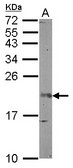 FGF12 Antibody - Sample (50 ug of whole cell lysate) A: mouse brain 12% SDS PAGE FGF12 antibody diluted at 1:1000