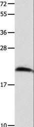 FGF12 Antibody - Western blot analysis of Mouse brain tissue, using FGF12 Polyclonal Antibody at dilution of 1:700.