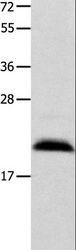 FGF12 Antibody - Western blot analysis of Mouse brain tissue, using FGF12 Polyclonal Antibody at dilution of 1:450.