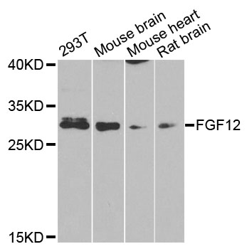 FGF12 Antibody - Western blot analysis of extracts of various cell lines.