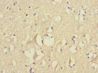 FGF12 Antibody - Immunohistochemistry of paraffin-embedded human brain tissue at dilution 1:100