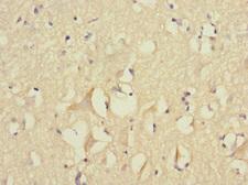 FGF12 Antibody - Immunohistochemistry of paraffin-embedded human brain tissue at dilution 1:100
