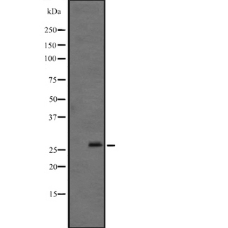 FGF12 Antibody - Western blot analysis of FGF12 expression in mouse brain lysate. The lane on the left is treated with the antigen-specific peptide.
